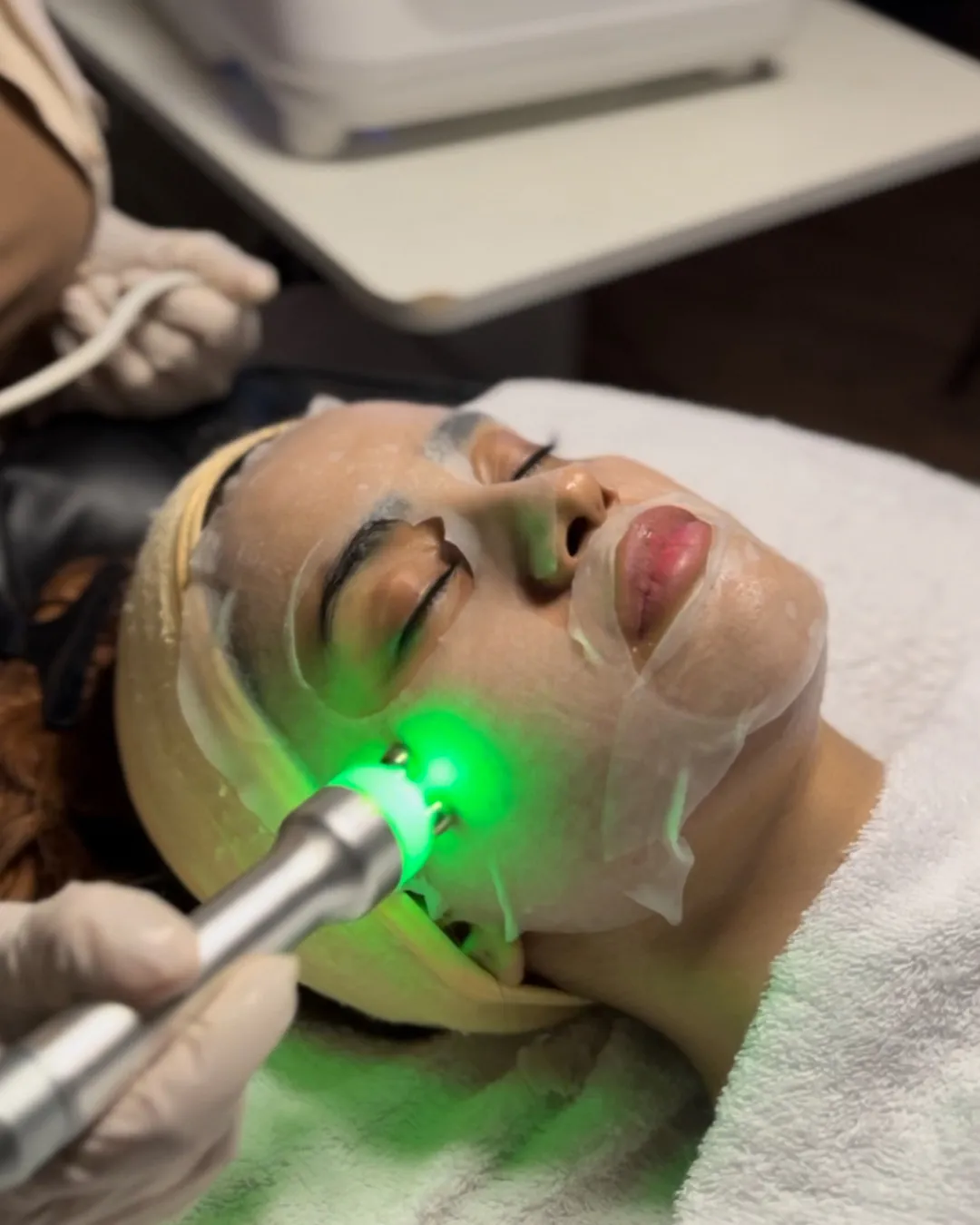 _Hydra facial 03